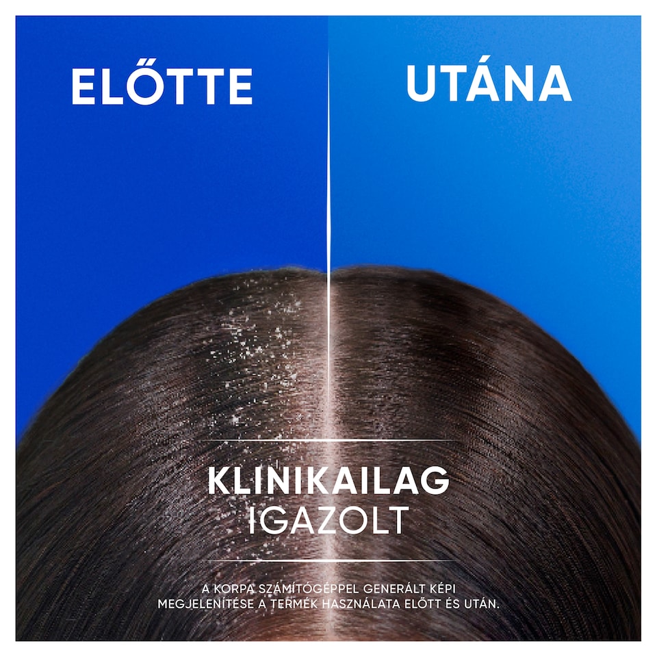 image 1 of Head & Shoulders Classic Clean 2in1 Anti Dandruff Shampoo 625ml. Refreshing Clean Scent