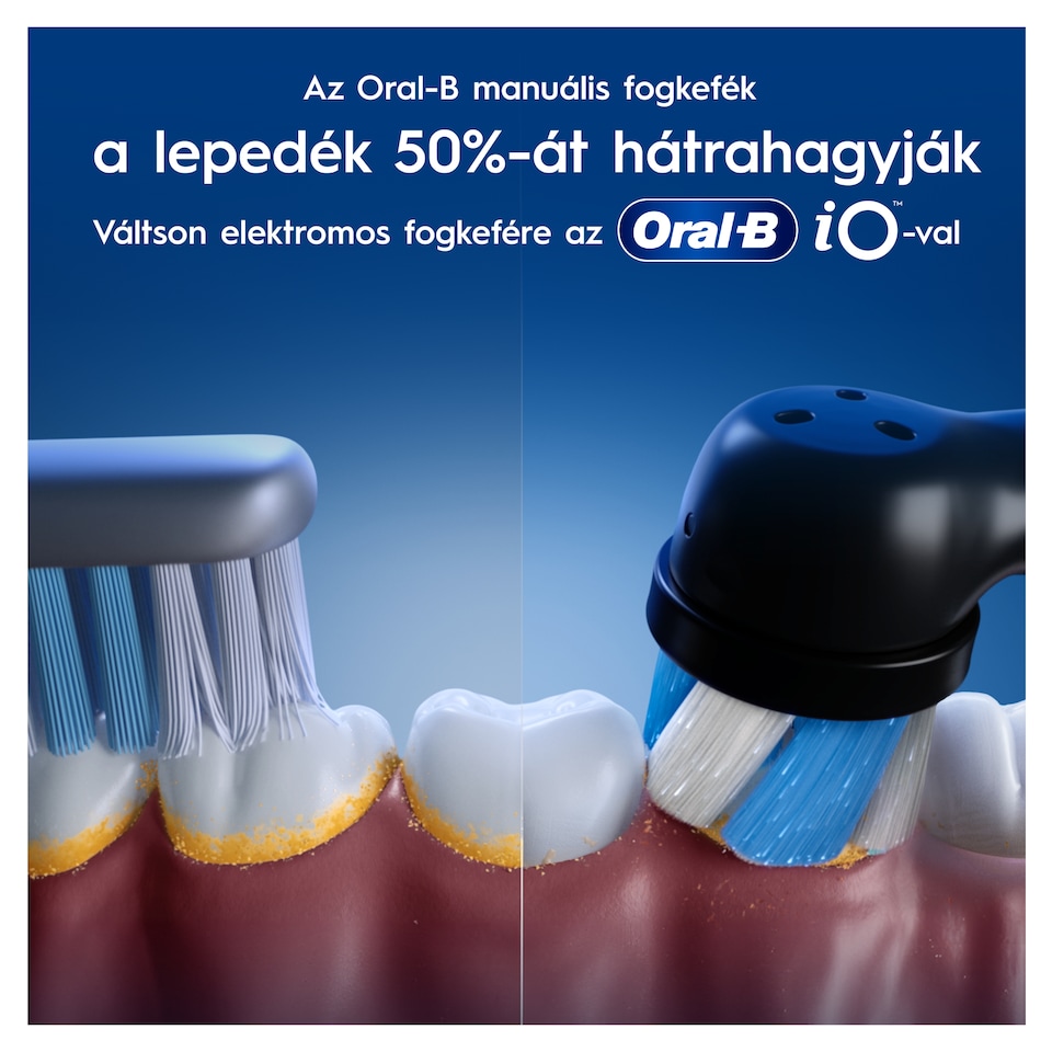 ORAL-B Junior Manuális Fogkefe – Extra Puha Sörték – 6–12 Éveseknek, 1  1. kép
