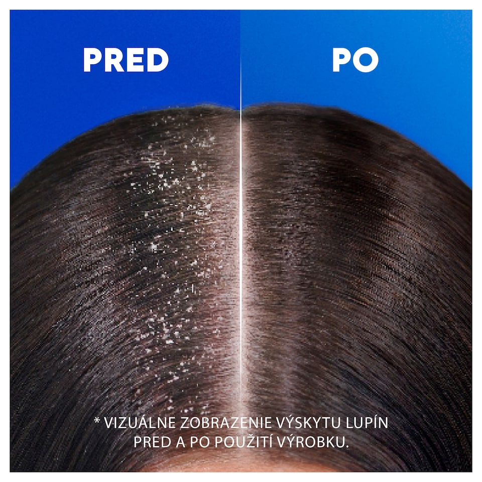 obrázok 1 z Head & Shoulders Classic Clean Šampón proti Lupinám 500 ml Denné Použitie. Pocit Čistoty