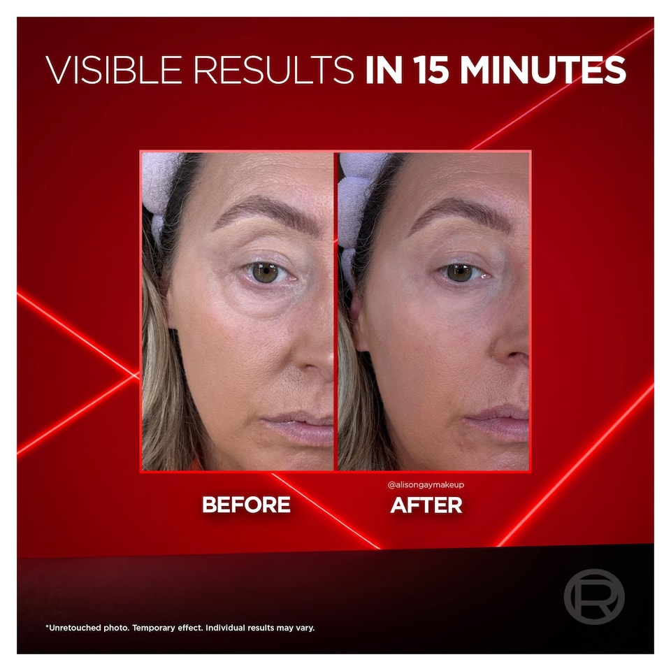 image 1 of L’OREAL PARIS REVITALIFT LASER EYE BAG INSTANT ERASER 15 ml