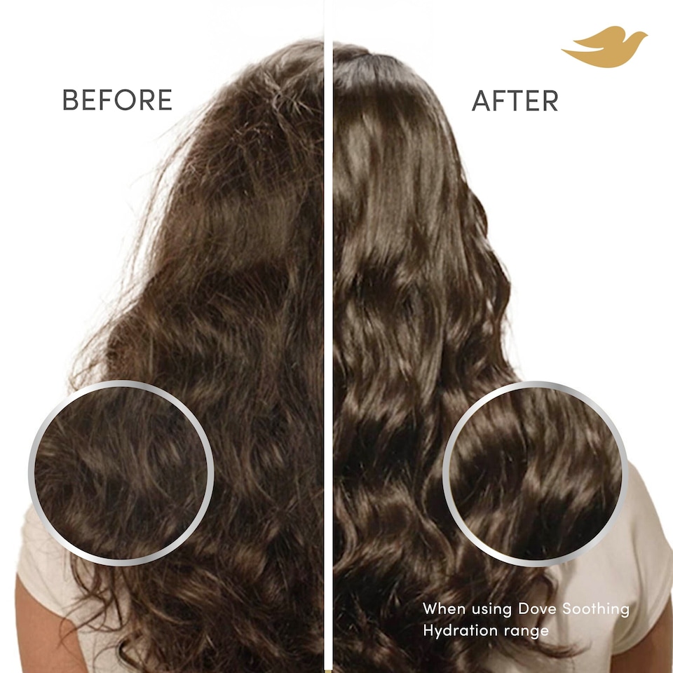 image 1 of Dove Scalp Hair Therapy Soothing Hydration Scalp Serum 45ml