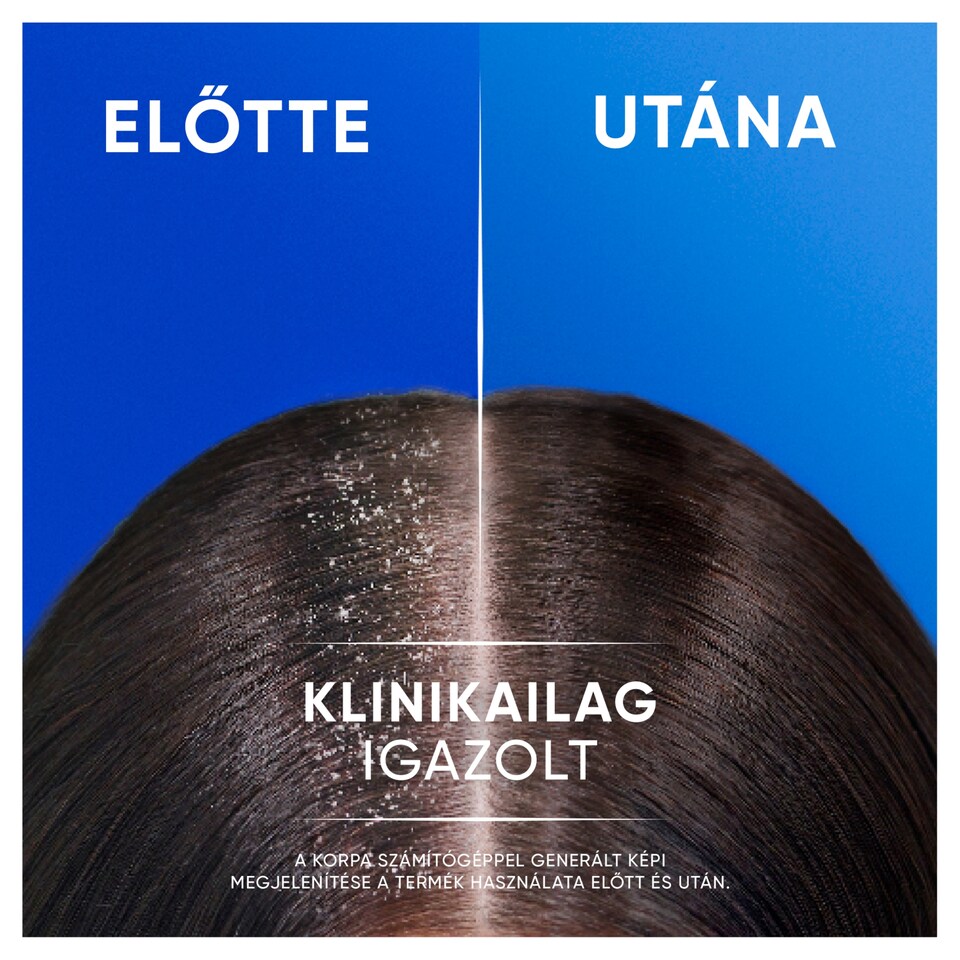 Head & Shoulders Classic Clean 2az1-ben korpásodás elleni sampon 625ml. Friss tiszta Illat 1. kép