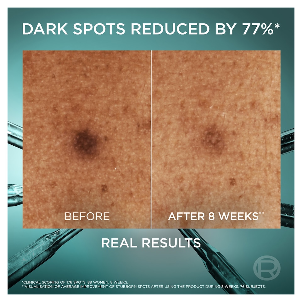 image 1 of L'Oreal Paris Bright Reveal Niacinamide Dark Spot Serum 30ml 