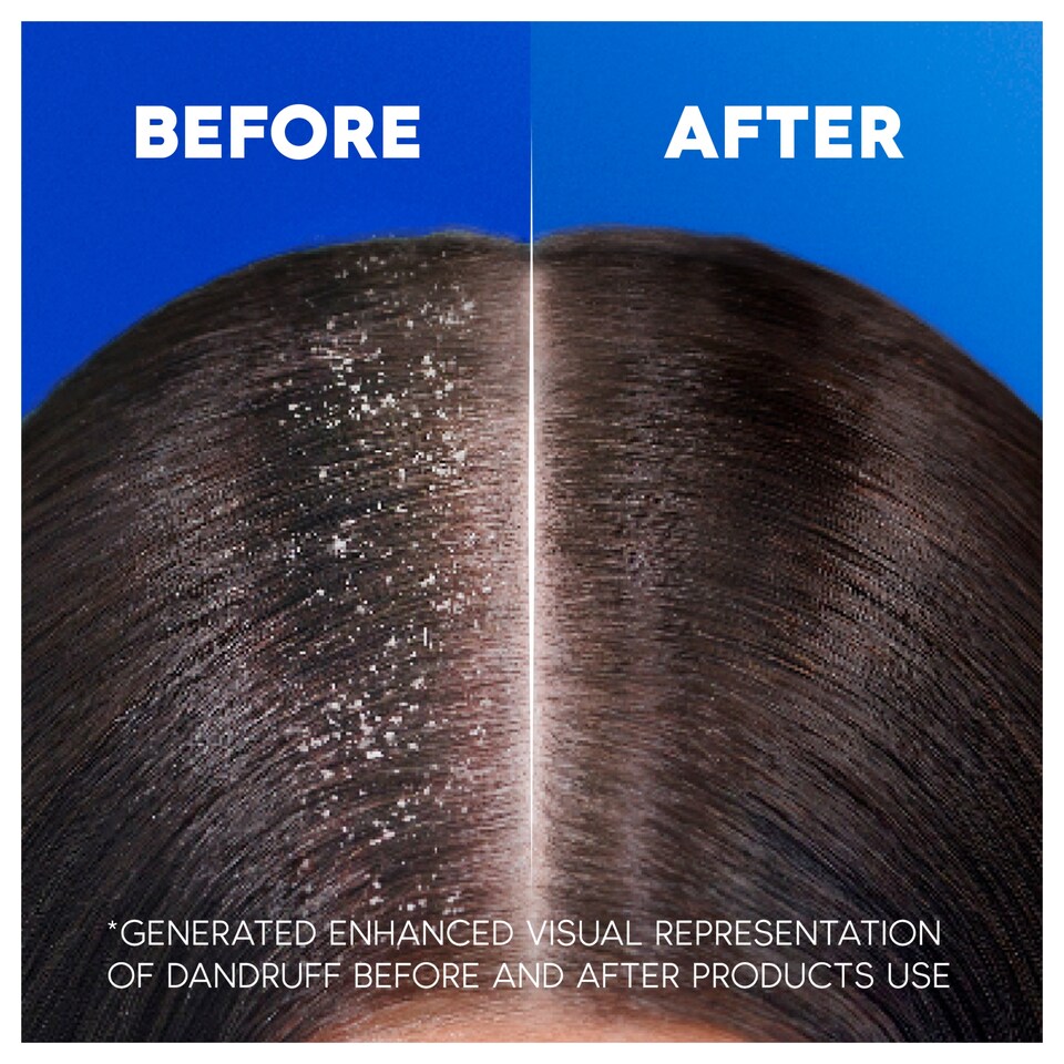 image 1 of Head and Shoulders Classic Clean Anti-Dandruff Shampoo 750ml