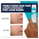 image 5 of CeraVe Resurfacing Retinol Serum with Ceramides & Niacinamide for Blemish-Prone Skin 30ml