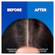 image 4 of Head & Shoulders 2 In 1 Itchy Scalp Anti Dandruff Shampoo 400Ml