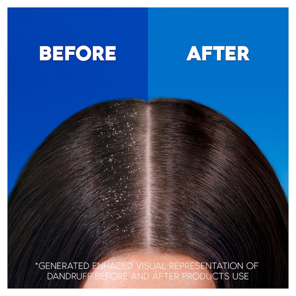 image 1 of Head & Shoulders 2 In 1 Itchy Scalp Anti Dandruff Shampoo 400Ml