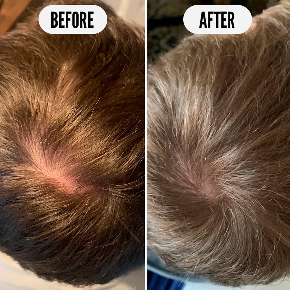 image 1 of Noughty Get Set Grow Tonic 75ml