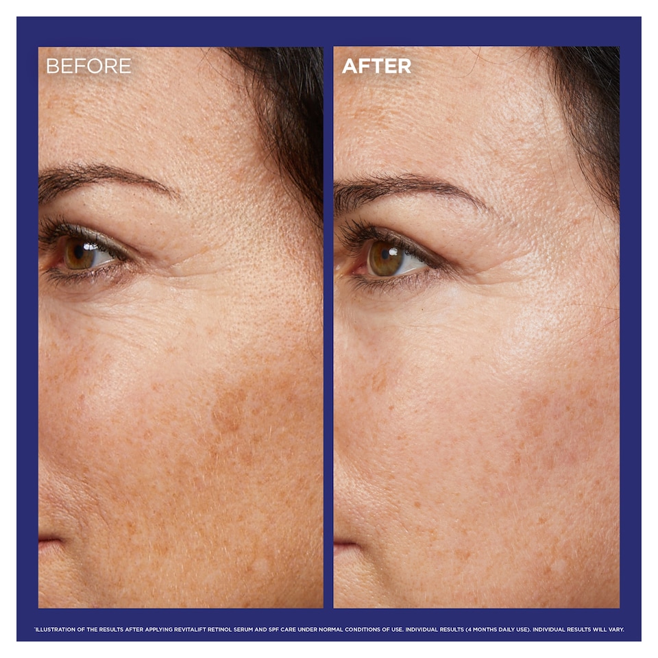 image 1 of L’Oreal Revitalift Laser Retinol Night Serum 30Ml