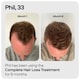 image 6 of Sons Hair Growth Shampoo with Saw Palmetto, Caffeine & Biotin, 1x200ml