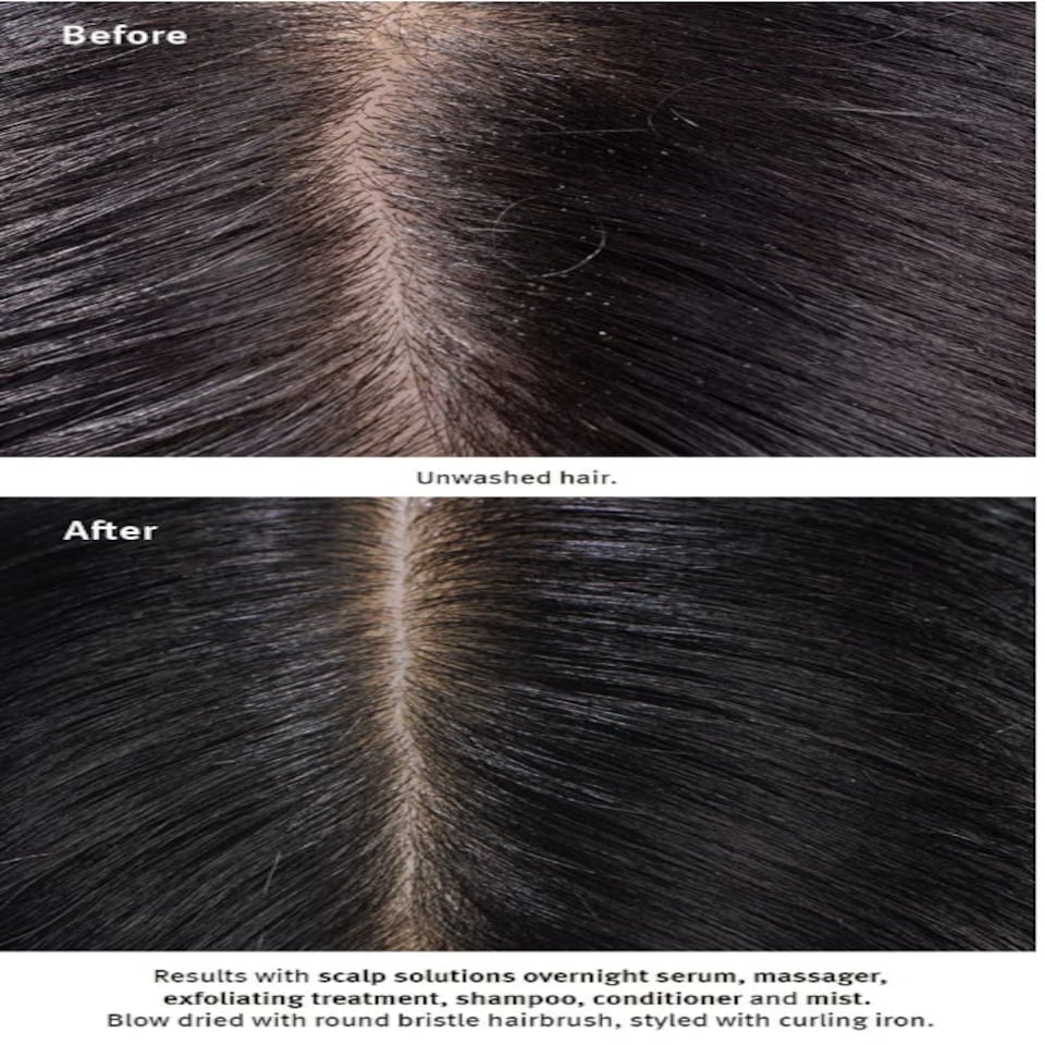 image 1 of Aveda Scalp Solutions Balancing Shampoo 200ml
