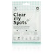 image 2 of Nature Spell Clear My Spots Pimple Patches  - 36 Translucent Hydrocolloid Patches
