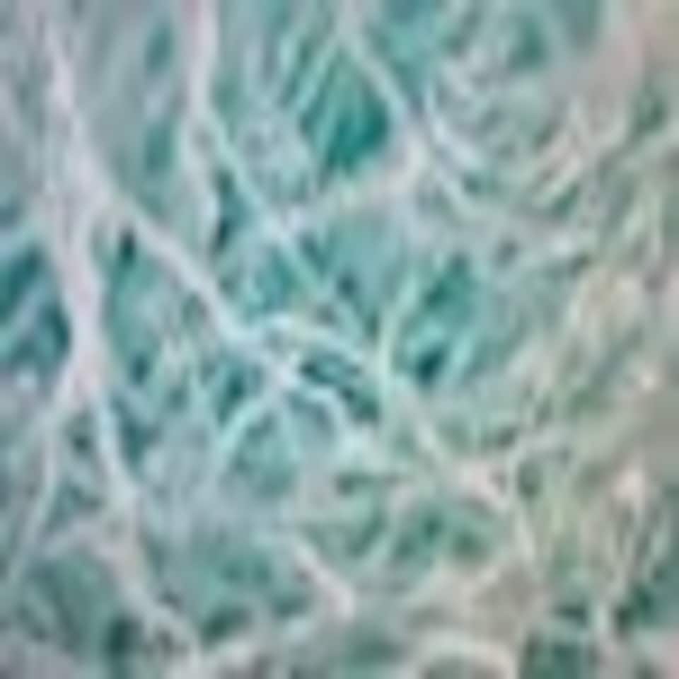 image 1 of Turquoise Shredded Tissue (20g)