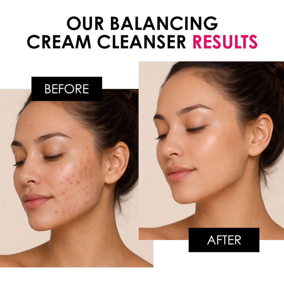 image 1 of skinChemists Balancing Vitamin C & Glycolic Acid Anti-Ageing Cream Cleanser 200ml for Acne, Blemishes, Large Pores, Dullness