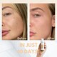 image 5 of Kanzen Skincare Derma Pore Purifier 125ml
