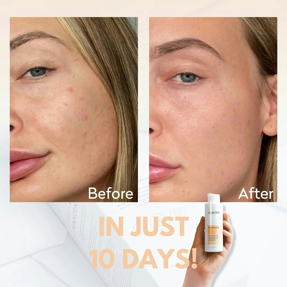 image 1 of Kanzen Skincare Derma Pore Purifier 125ml