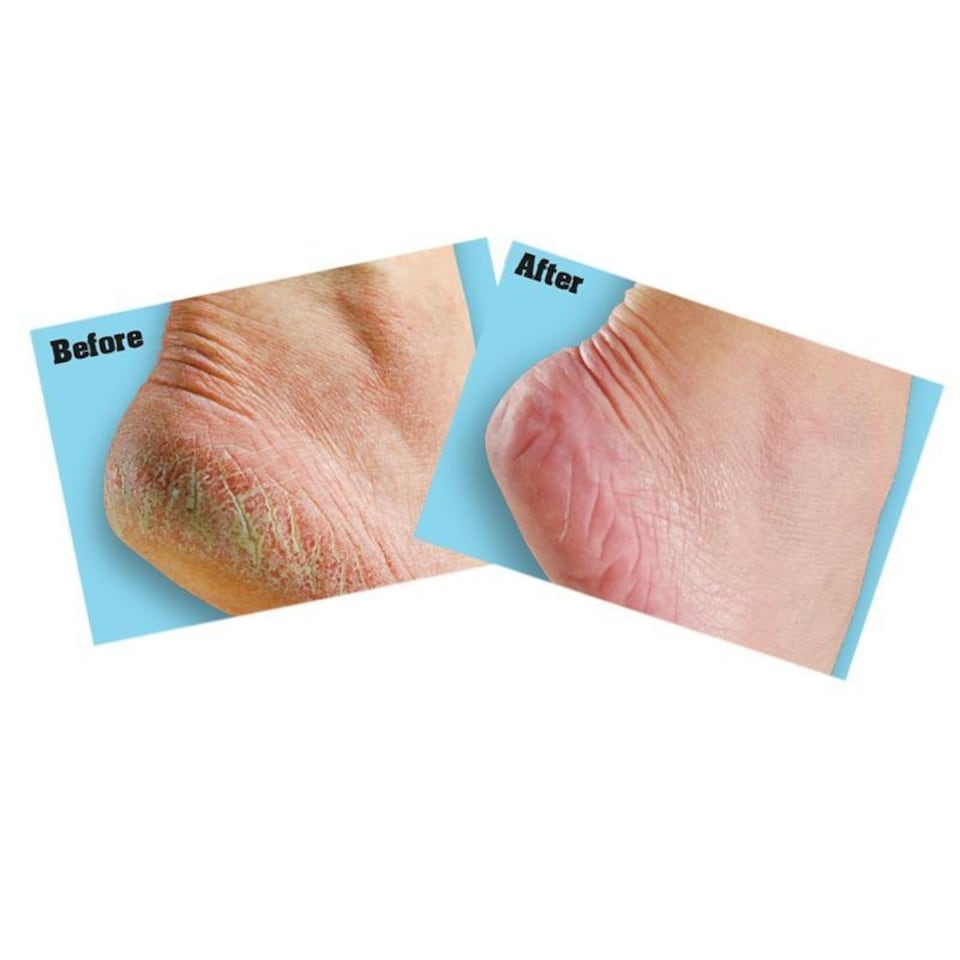 image 1 of Gorilla Glue O'keeffe's Healthy Feet Foot Cream