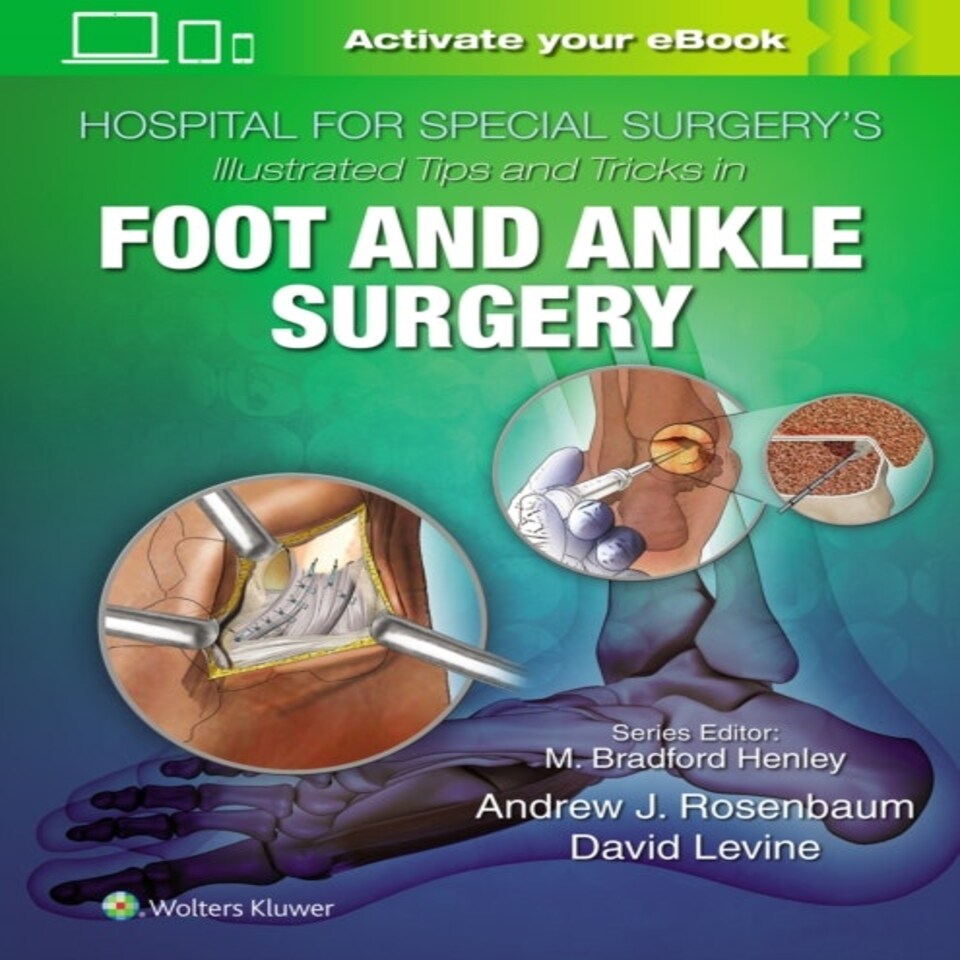 Hospital For Special Surgerys Illustrate
