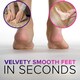 image 8 of NYK1 MegaFile Callus Remover for Feet with Catcher (XL Size) Rustproof Foot File for Wet & Dry Use