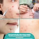 image 9 of Blackhead Remover Stainless Steel Comedone Extractor Acne Remover Tool