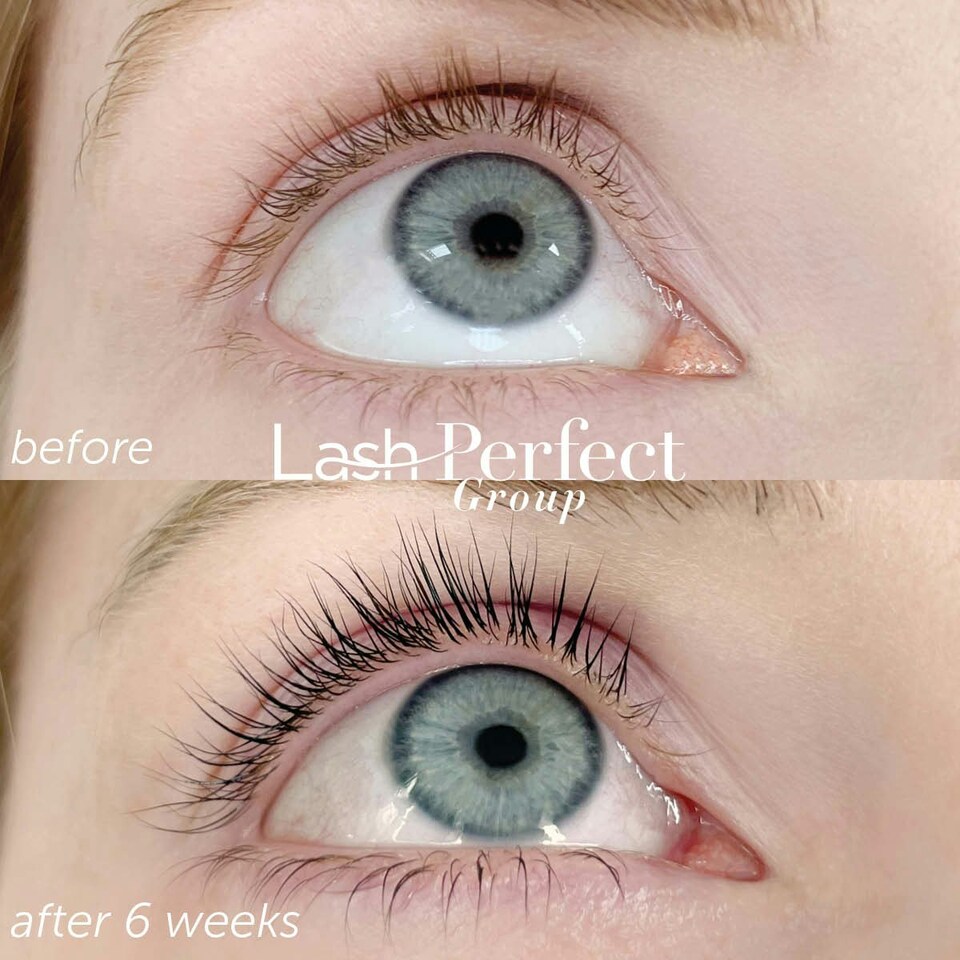 image 1 of Lash Revive - Intense Lash Growth Serum