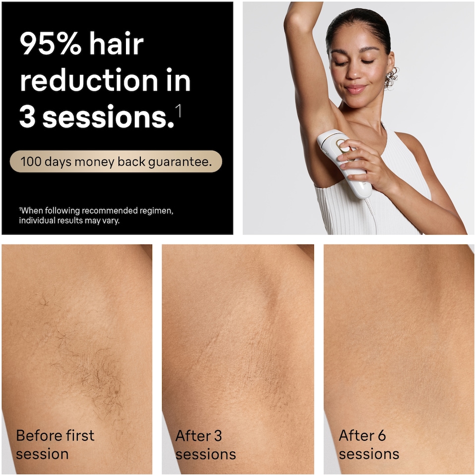 image 1 of Braun IPL Silk·expert Pro 5, At Home Hair Removal, 4 Attachment Heads, PL5441