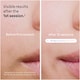 image 5 of Braun Smart IPL Skin i·expert, At Home Hair Removal, Pouch, Venus Razor, 2 Heads, PL7147