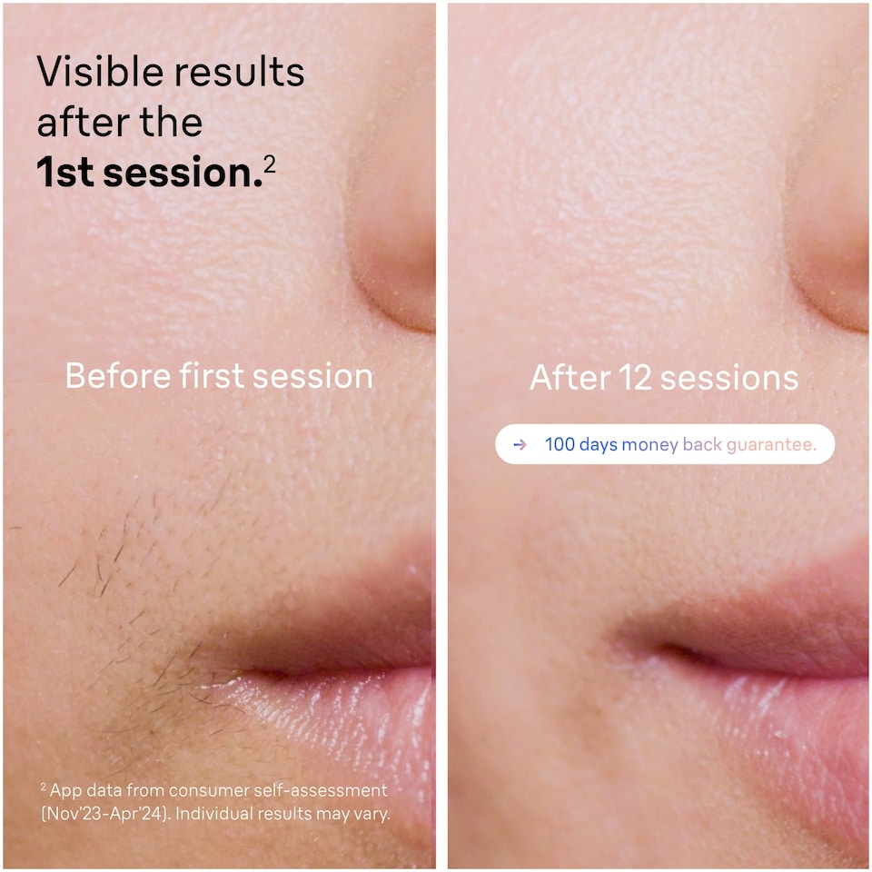 image 1 of Braun Smart IPL Skin i·expert, At Home Hair Removal, Pouch, Venus Razor, 2 Heads, PL7147