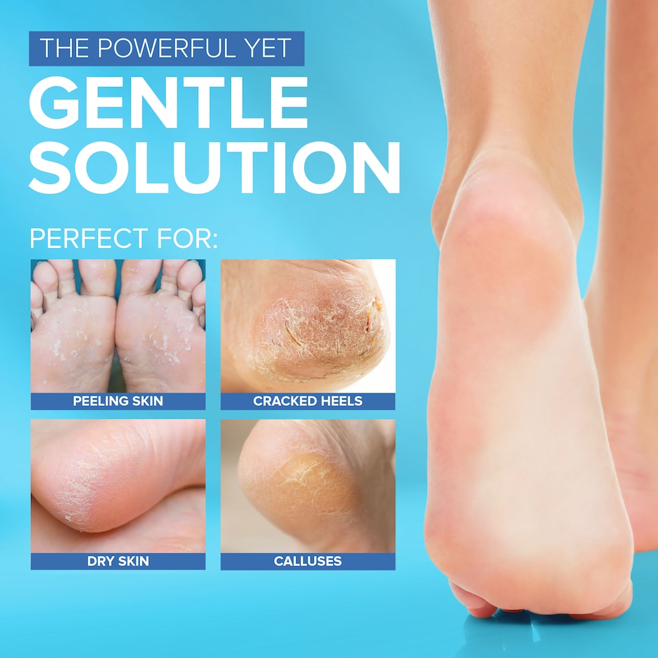 image 1 of NYK1 Smoothie Waterproof Foot File (for Wet & Dry Use) High-Performance Feet Exfoliator