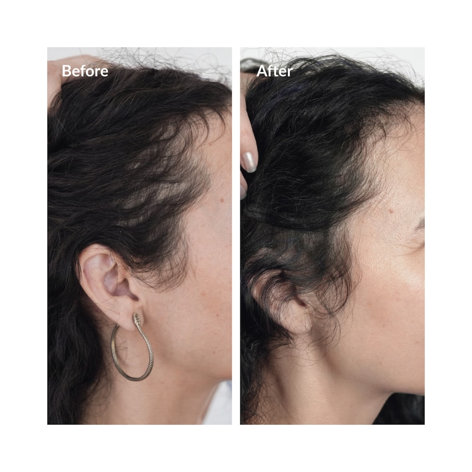 image 1 of Rosemary Hair Oil Co Intense Growth Syrup
