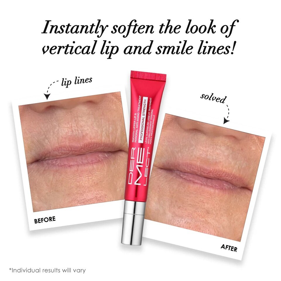 image 1 of SMOOTH UPPER LIP PROFESSIONAL