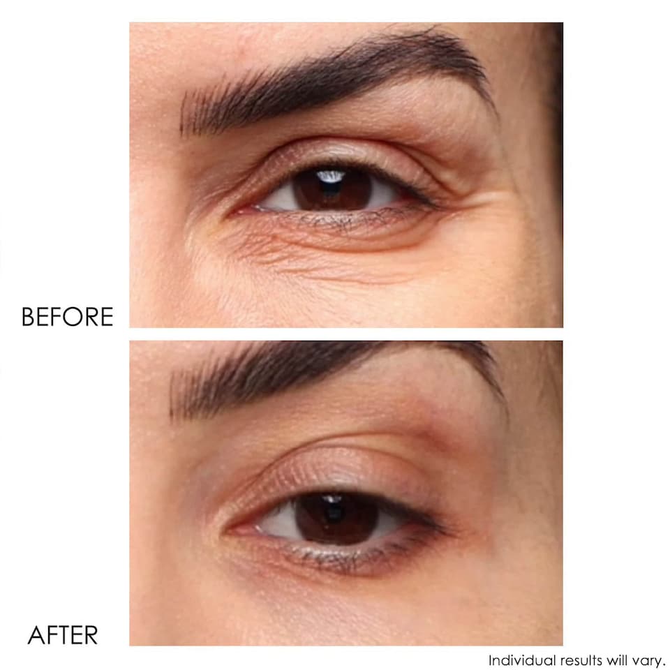 image 1 of REVITALITE PROFESSIONAL Eyelid & Dark Circle Corrector