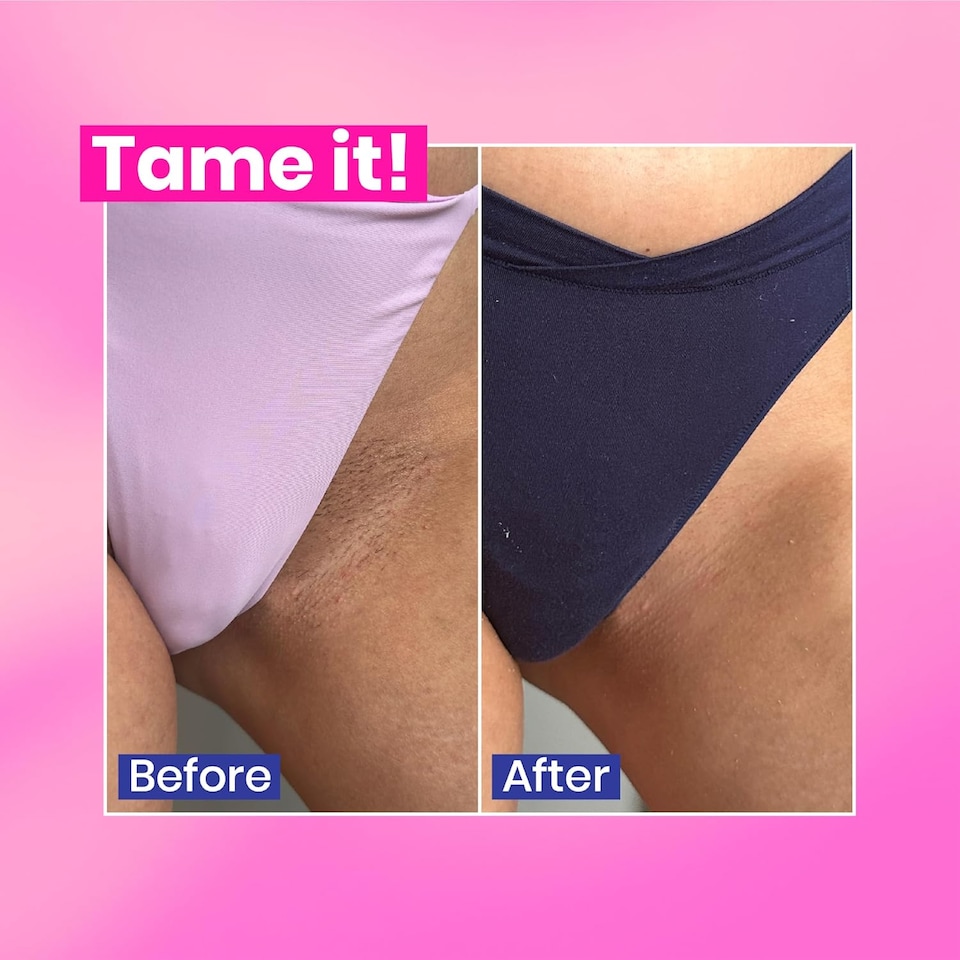 image 1 of WooWoo Tame It Natural Intimate Hair Removal Cream - Painless Vegan Hair Remover For Sensitive Skin - 100ml
