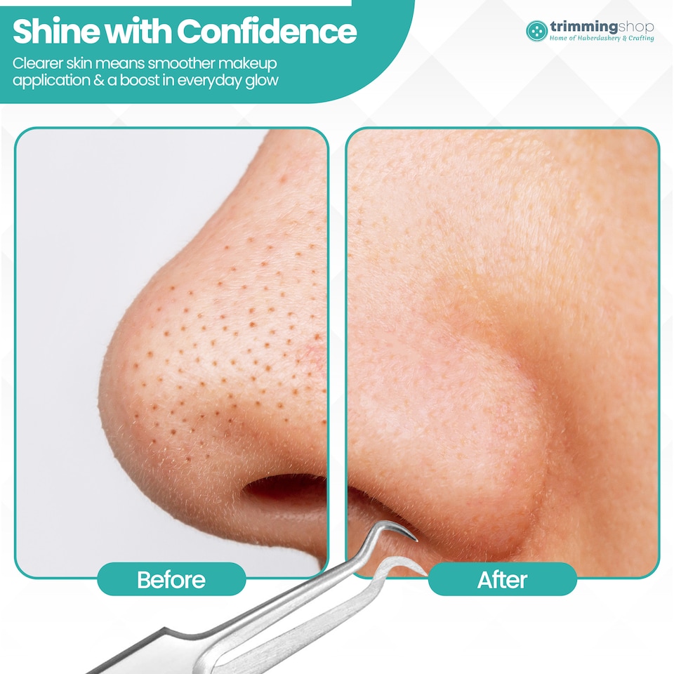 image 1 of Blackhead Remover Stainless Steel Comedone Extractor Acne Remover Tool