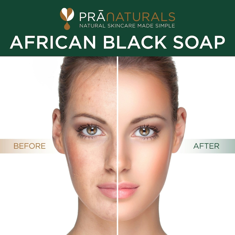 image 1 of PraNaturals 100% Organic African Black Soap 200g