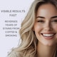 image 6 of Smile Science Harley Street Teeth Whitening Strips