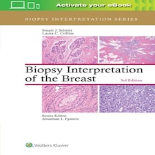 Biopsy Interpretation Of The Breast