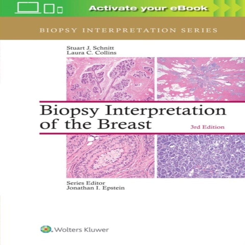 Biopsy Interpretation Of The Breast