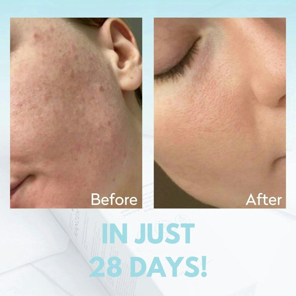 image 1 of Kanzen Skincare Derma Cleansing Anti-bacterial Water 125ml