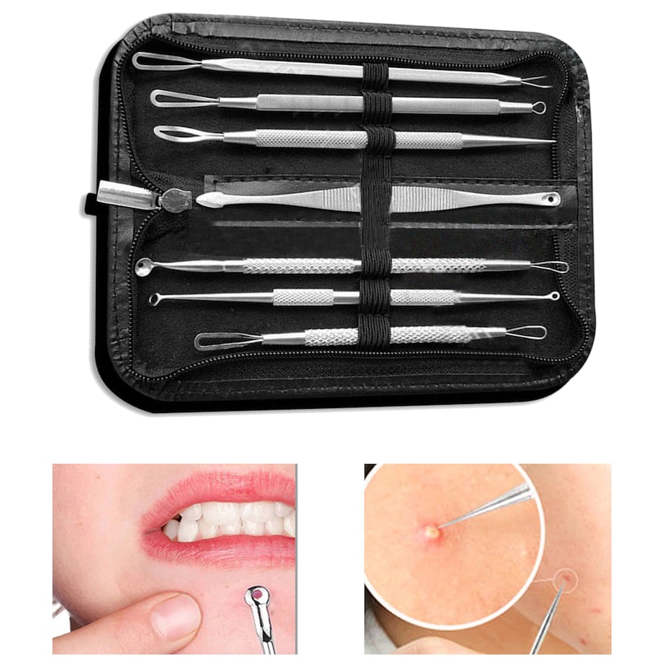 image 1 of Blackhead Remover Set, Pimple Extractor Tool with Case Comedone - 7pcs