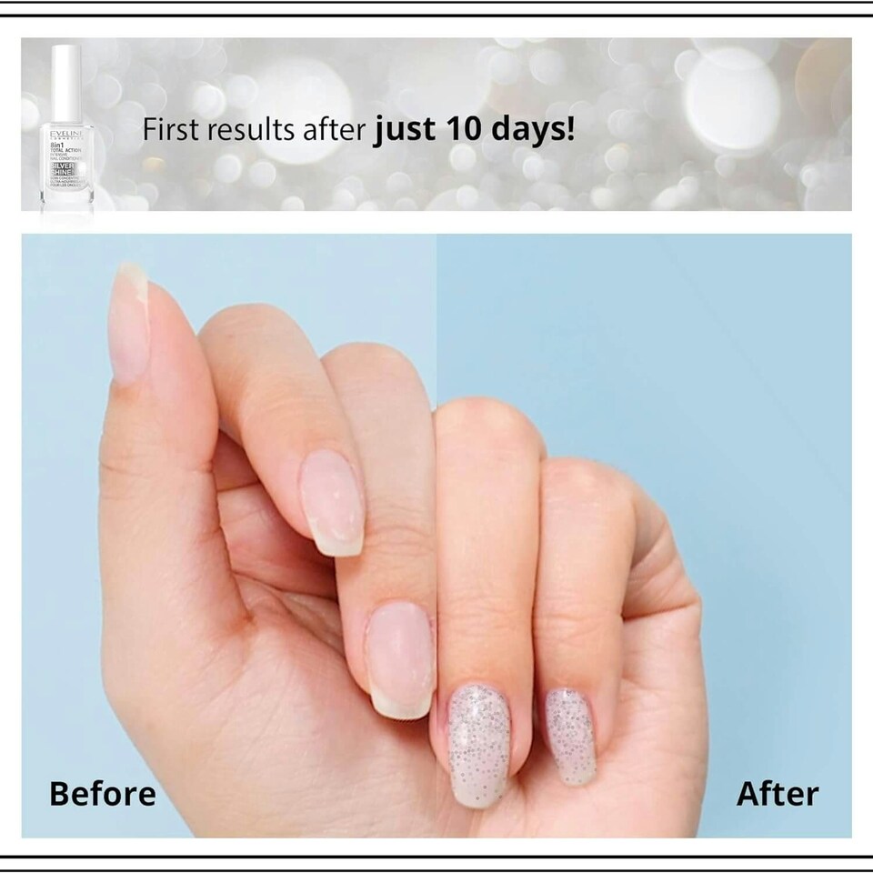 image 1 of Eveline Nail Therapy Total Action Concentrated Nail Conditioner with Silver Particles 8in1 Silver Shine 12ml
