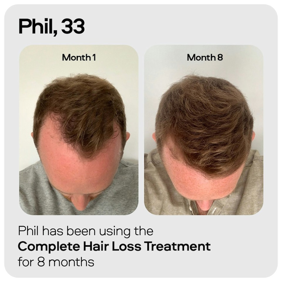 image 1 of Sons Hair Strengthening Shampoo & Conditioner For Men - 3 Month Pack