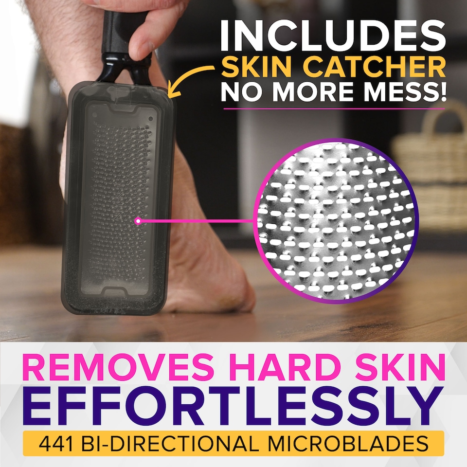 image 1 of NYK1 MegaFile Callus Remover for Feet with Catcher (XL Size) Rustproof Foot File for Wet & Dry Use