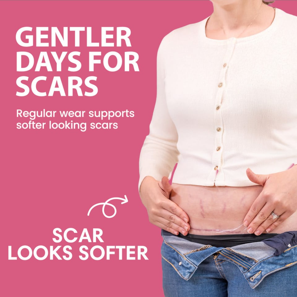 image 1 of Booby Tape Silicone Scar Patches, Protect and Hydrate the Skin while Helping Old and New Scars Fade Away More Easily, Suitable for Post-Surgery Scars 6 x 20.5cm Reusable Patches