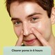 image 5 of Skin Choice Breakout Nose Patches, Hydrocolloid Pore Strips - 5pk