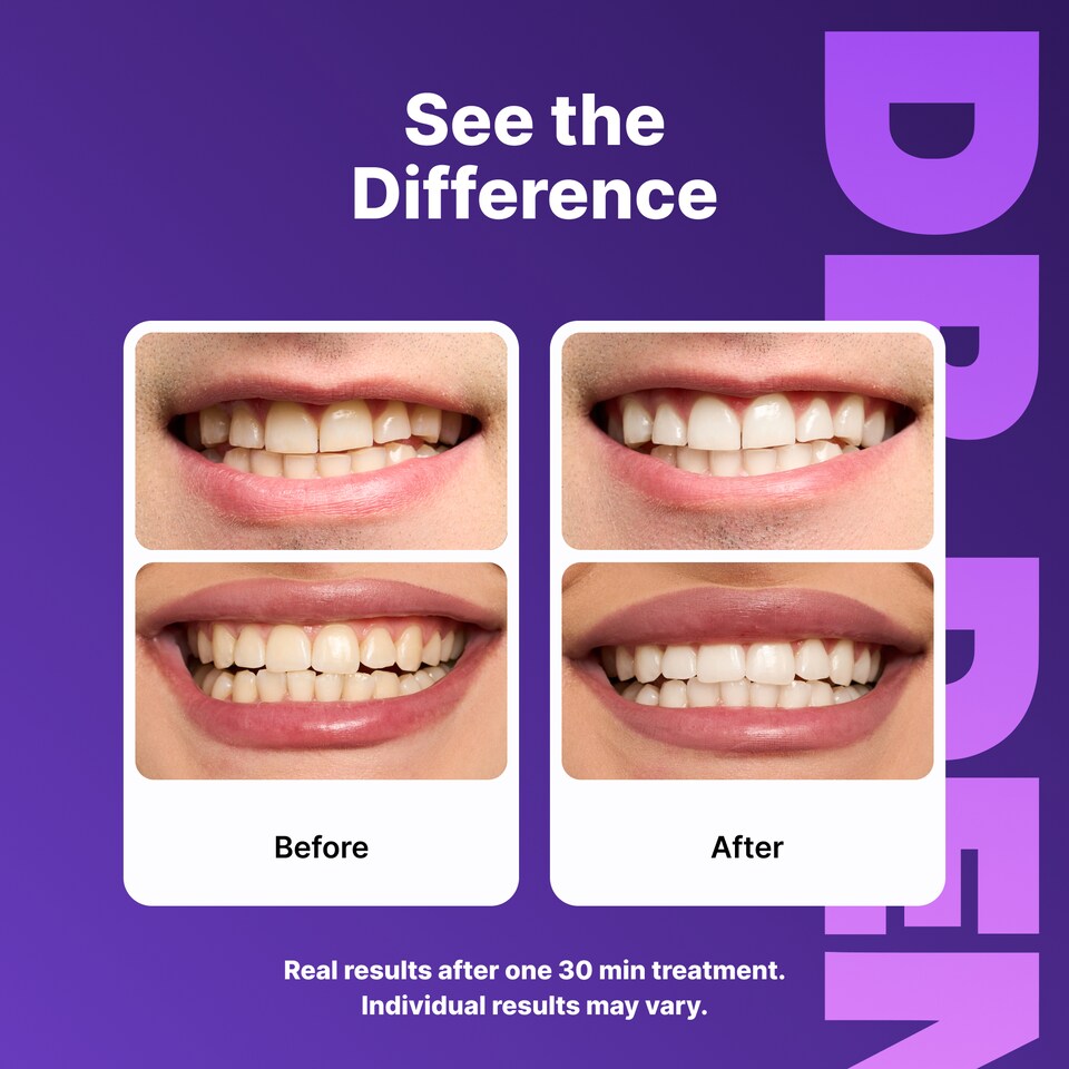 image 1 of DR.DENT Purple Teeth Whitening Strips, 42 Strips