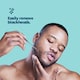 image 8 of Blackhead Removal Kit