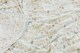 image 4 of Copper Pearl 3 Layer Jumbo Quilt Rex