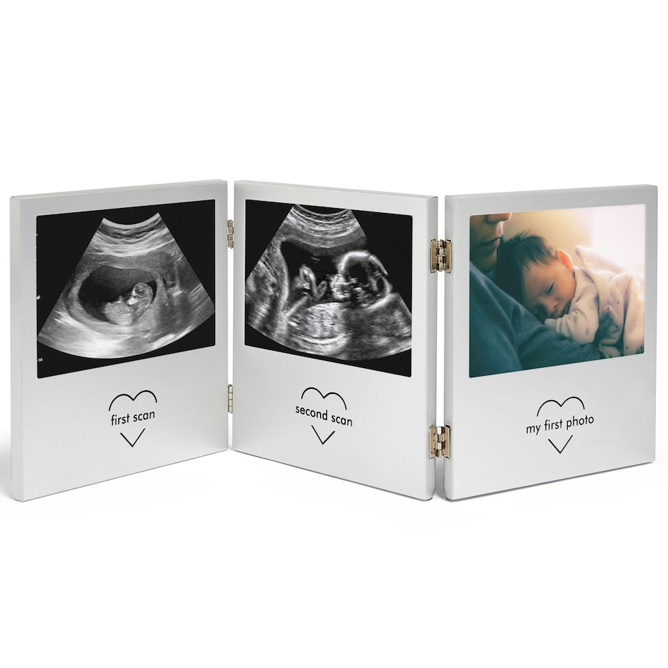 image 1 of VonHaus Baby Scan Photo Frame Multi-Photo Picture Frame Triple Photo