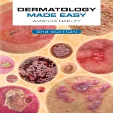 Dermatology Made Easy Second Edition